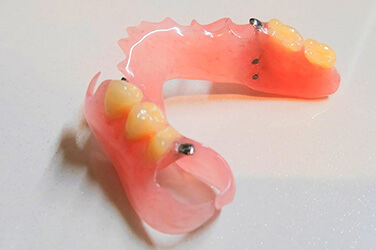 ノンクラスプデンチャー