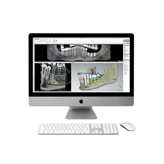 治療計画の説明のイメージ