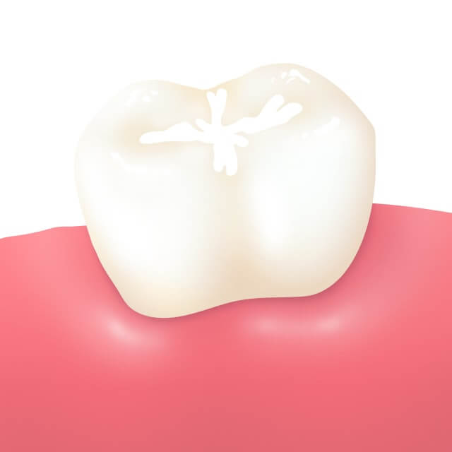 シーラントイメージ