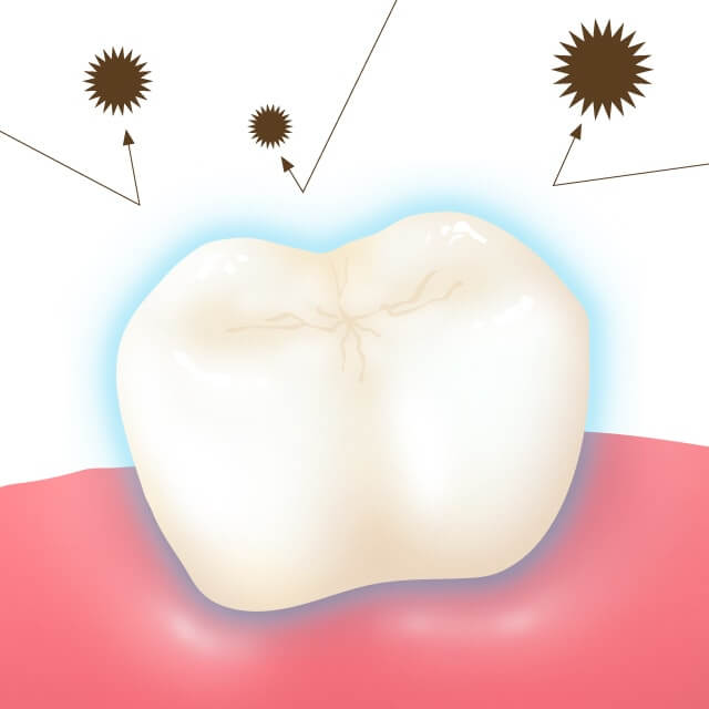 フッ素塗布イメージ